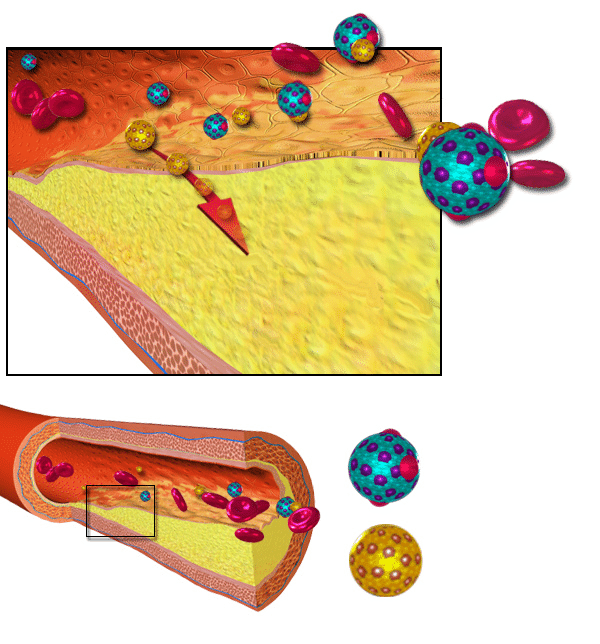 LDL particles